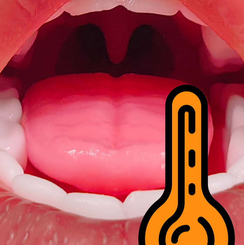 oral heating function upgrade